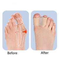 Kaksinkertainen varvasseurain hallux valgus – pehmeä silikonista, 2-pakkaus
