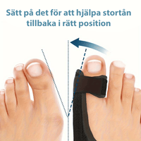 Pehmeä varvaserotin hallux valgusta vastaan – purkaa isovarvasta